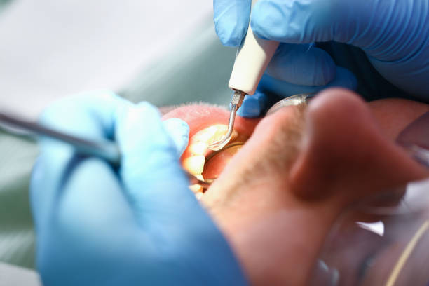 Best Emergency Dentist for Knocked-Out Tooth in Evadale, TX